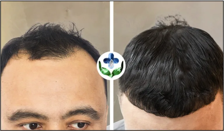 Screenshot 2025-07-04 at 10.33.42 AM